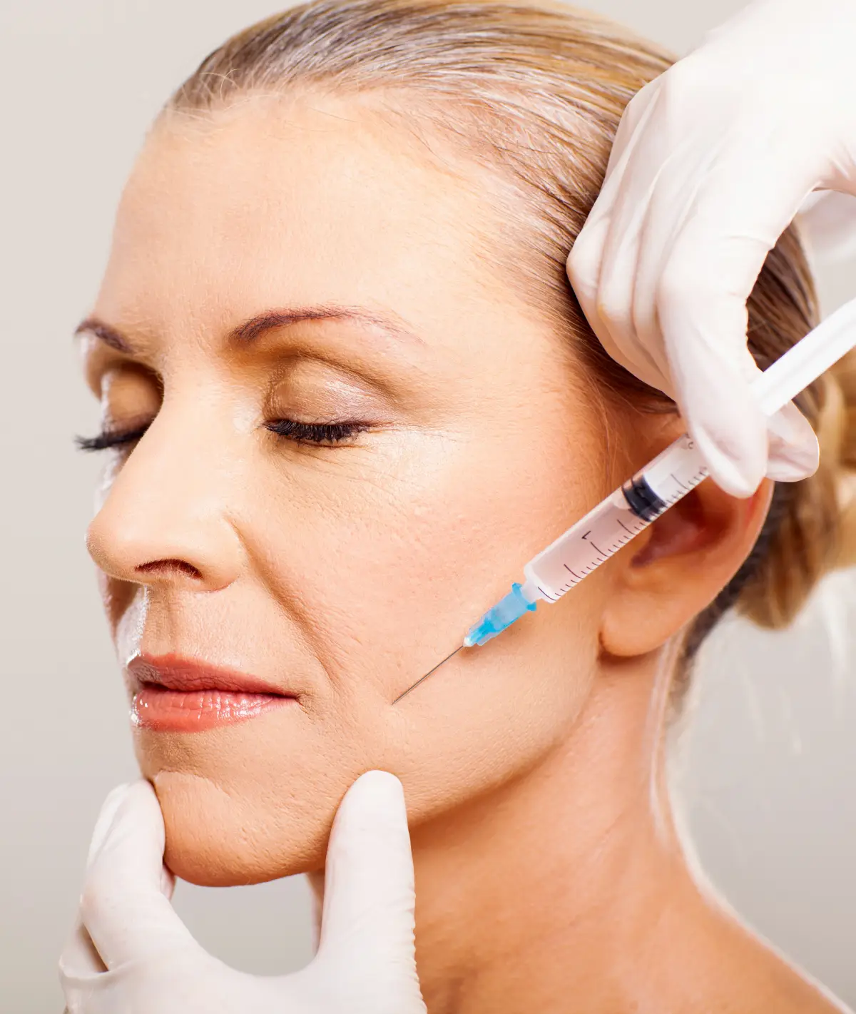 Woman receiving a biostimulator aesthetic treatment