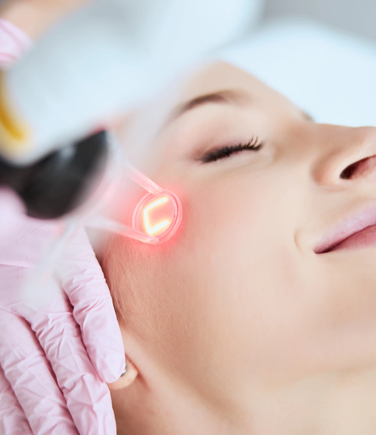 Laser skin resurfacing treatment for wrinkle reduction and skin renewal