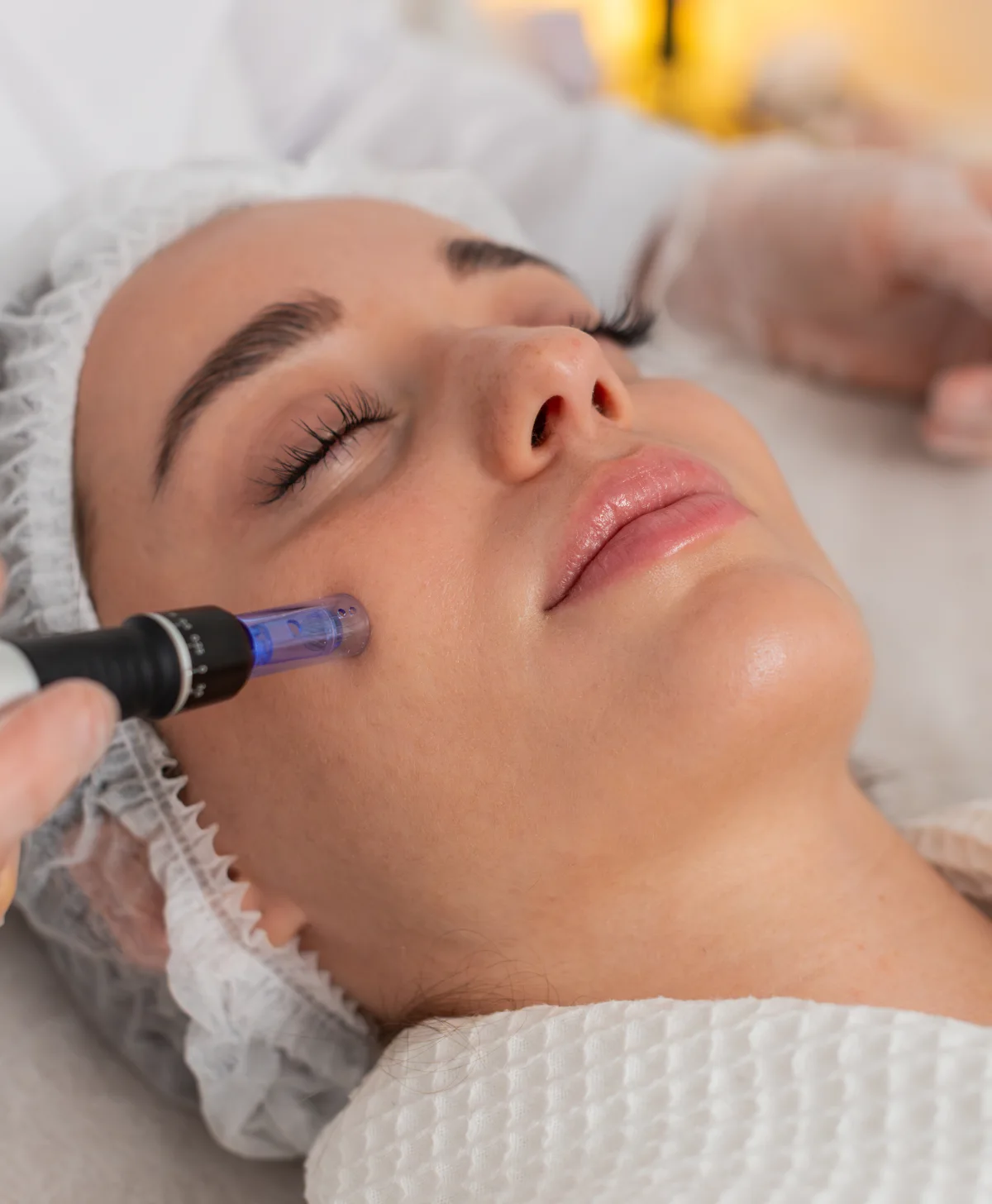 Microneedling facial treatment for skin rejuvenation and collagen production
